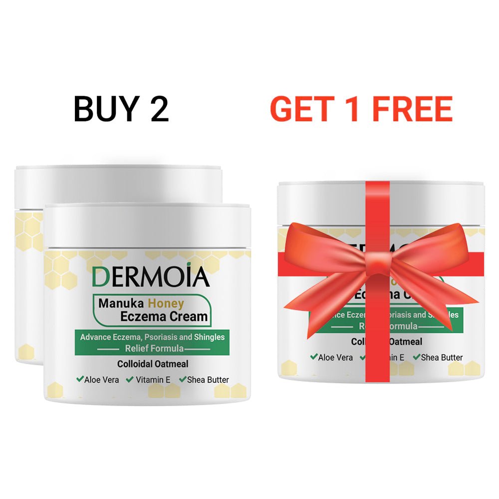 ECZEMA CREAM
